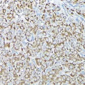 Anti-RPS15A antibody used in IHC (Paraffin sections) (IHC-P). GTX64972