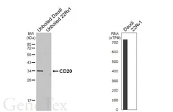 Anti-CD20 antibody [GT450] used in Western Blot (WB). GTX649726