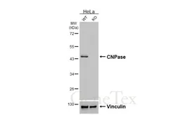 Anti-CNPase antibody [HL6881] used in Western Blot (WB). GTX649733