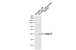 Anti-CREST antibody [HL6890] used in Western Blot (WB). GTX649742