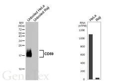 Anti-CD59 antibody [HL6893] used in Western Blot (WB). GTX649745