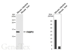 Anti-FABP2 antibody [HL6897] used in Western Blot (WB). GTX649749