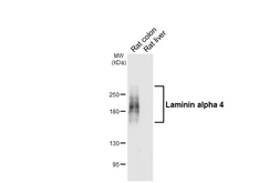 Anti-Laminin alpha 4 antibody [HL6906] used in Western Blot (WB). GTX649758