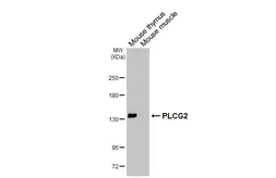 Anti-PLCG2 antibody [HL6910] used in Western Blot (WB). GTX649762