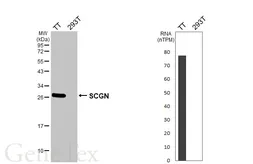 Anti-SCGN antibody [HL6921] used in Western Blot (WB). GTX649778