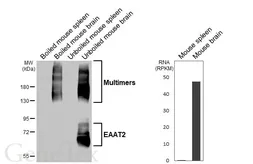 Anti-EAAT2 antibody [HL6927] used in Western Blot (WB). GTX649784