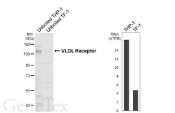 Anti-VLDL Receptor antibody [HL6941] used in Western Blot (WB). GTX649798
