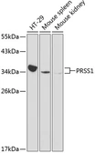 Anti-PRSS1 antibody used in Western Blot (WB). GTX64980