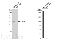 Anti-CD74 antibody [HL6948] used in Western Blot (WB). GTX649805
