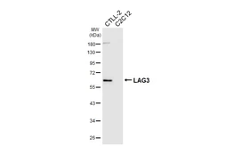 Anti-LAG3 antibody [HL6949] used in Western Blot (WB). GTX649806