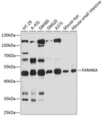 Anti-FAM46A antibody used in Western Blot (WB). GTX64981