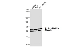 Anti-Ezrin + Radixin + Moesin antibody [HL6955] used in Western Blot (WB). GTX649812
