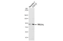 Anti-TFE3 antibody [HL6956] used in Western Blot (WB). GTX649813