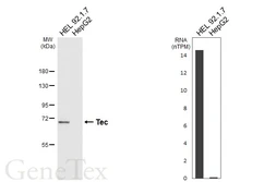 Anti-Tec antibody [HL6960] used in Western Blot (WB). GTX649817