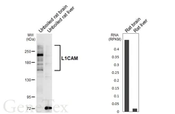 Anti-L1CAM antibody [GT455] used in Western Blot (WB). GTX649820