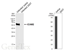 Anti-ICAM2 antibody [HL6972] used in Western Blot (WB). GTX649834