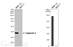 Anti-Calponin 3 antibody [HL6984] used in Western Blot (WB). GTX649846