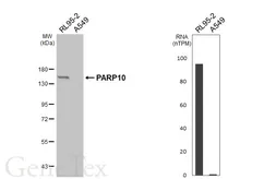 Anti-PARP10 antibody [HL6986] used in Western Blot (WB). GTX649848