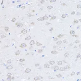 Anti-UBE4A antibody used in IHC (Paraffin sections) (IHC-P). GTX64985