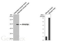 Anti-PFKFB1 antibody [HL6989] used in Western Blot (WB). GTX649851