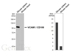 Anti-VCAM1 / CD106 antibody [HL6990] used in Western Blot (WB). GTX649852