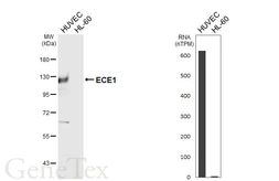 Anti-ECE1 antibody [HL6991] used in Western Blot (WB). GTX649853