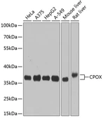 Anti-CPOX antibody used in Western Blot (WB). GTX64986