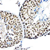 Anti-SF3A3 antibody used in IHC (Paraffin sections) (IHC-P). GTX64988
