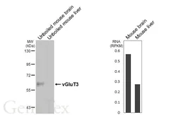Anti-vGluT3 antibody [HL7007] used in Western Blot (WB). GTX649880