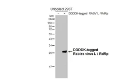 Anti-Rabies virus L / RdRp antibody [HL7010] used in Western Blot (WB). GTX649883