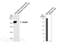 Anti-GluR2 antibody [HL7015] used in Western Blot (WB). GTX649888