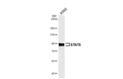 Anti-STAT5 antibody [HL7028] used in Western Blot (WB). GTX649901