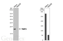 Anti-TIMP2 antibody [HL7032] used in Western Blot (WB). GTX649905