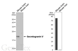 Anti-Secretogranin V antibody [HL7043] used in Western Blot (WB). GTX649916