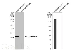 Anti-Calretinin antibody [GT468] used in Western Blot (WB). GTX649926