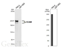 Anti-L1CAM antibody [GT470] used in Western Blot (WB). GTX649927