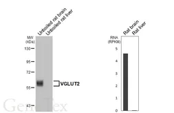 Anti-VGLUT2 antibody [HL7073] used in Western Blot (WB). GTX649955