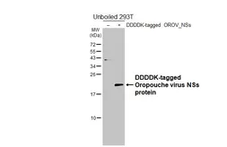 Anti-Oropouche virus NSs protein antibody [HL7083] used in Western Blot (WB). GTX649965