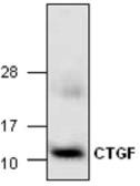 Human Cathepsin B protein (active). GTX65065-pro