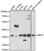 Anti-DIMT1 antibody used in Western Blot (WB). GTX65532