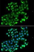 Anti-PHF11 antibody used in Immunocytochemistry/ Immunofluorescence (ICC/IF). GTX65536