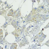 Anti-SOCS6 antibody used in IHC (Paraffin sections) (IHC-P). GTX65551