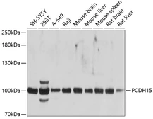 Anti-PCDH15 antibody used in Western Blot (WB). GTX65556