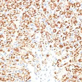 Anti-KLHL9 antibody used in IHC (Paraffin sections) (IHC-P). GTX65557