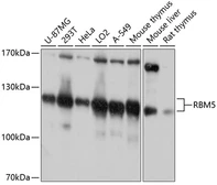 Anti-RBM5 antibody used in Western Blot (WB). GTX65561