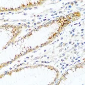 Anti-FAM3B antibody used in IHC (Paraffin sections) (IHC-P). GTX65562