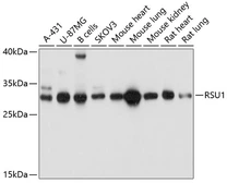 Anti-RSU1 antibody used in Western Blot (WB). GTX65563