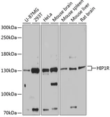 Anti-HIP1R antibody used in Western Blot (WB). GTX65566