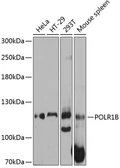 Anti-POLR1B antibody used in Western Blot (WB). GTX65567