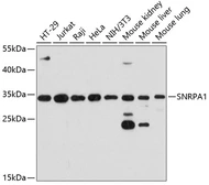 Anti-SNRPA1 antibody used in Western Blot (WB). GTX65569